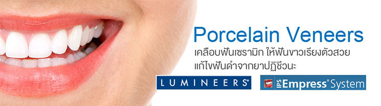 Smile Makeover Veneers Smile Makeover Veneers