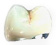 Dental crowns Dental crowns