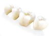 Dental Bridge Dental Bridge