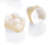 Restore Your Smile with Dental Crowns Restore Your Smile with Dental Crowns