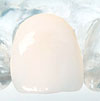 All Porcelain Veneers for A Smile Makeover. All Porcelain Veneers for A Smile Makeover.